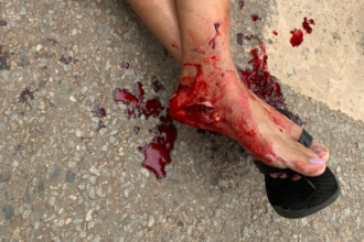 Cão raivoso ataca pedestre e PM intervém em situação crítica no oeste de Goianésia