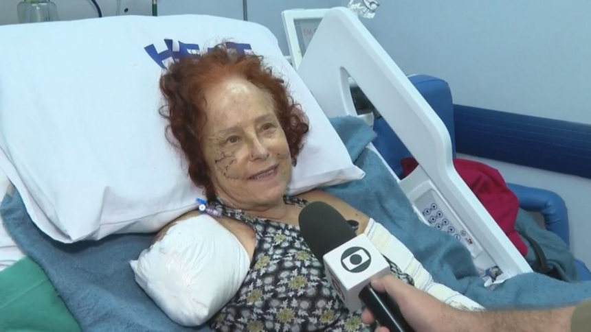 Roseana Murray Usa Prótese Biônica Após Perder Braço em Ataque de Pitbulls