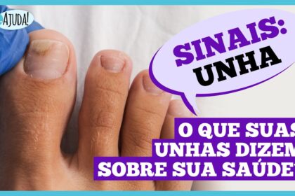 Dr. Ajuda: Unhas fracas podem indicar problemas de saúde
