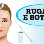 Dr. Ajuda: rugas e botox