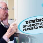 Hidrocefalia de pressão normal