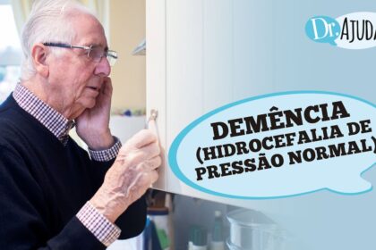 Hidrocefalia de pressão normal