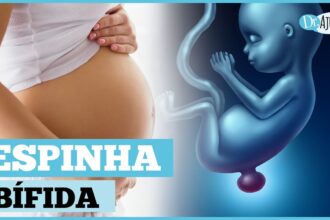 O que é e como prevenir a mielomeningocele?