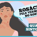 Rosácea: o que é e quais são os sintomas
