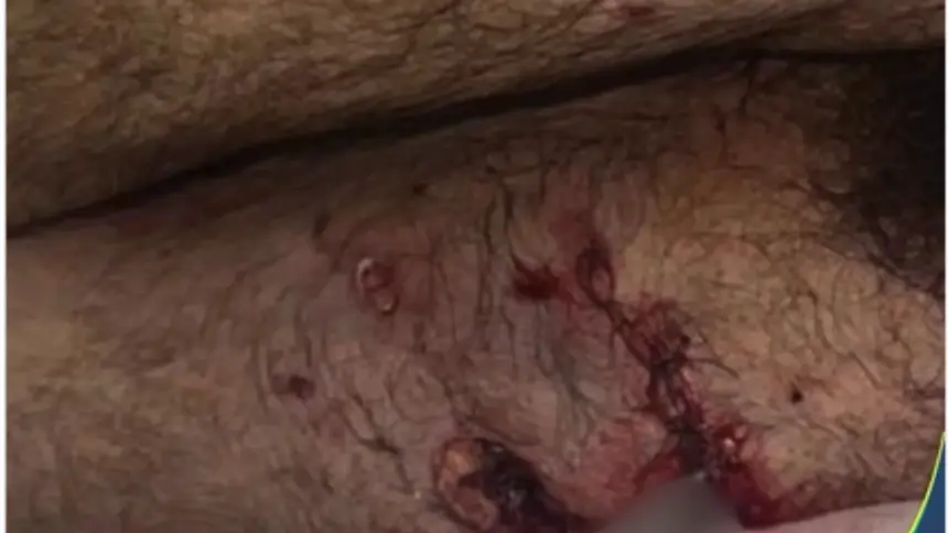 Ataque de pitbull deixa homem ferido no oeste de Goianésia Ataque de pitbull deixa homem ferido no oeste de Goianésia