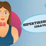 Hipertireoidismo, o que é?