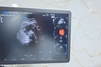 Renato de Castro anuncia parceria com deputada Flávia Moraes e traz clínica móvel com exames gratuitos