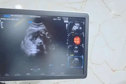 Renato de Castro anuncia parceria com deputada Flávia Moraes e traz clínica móvel com exames gratuitos