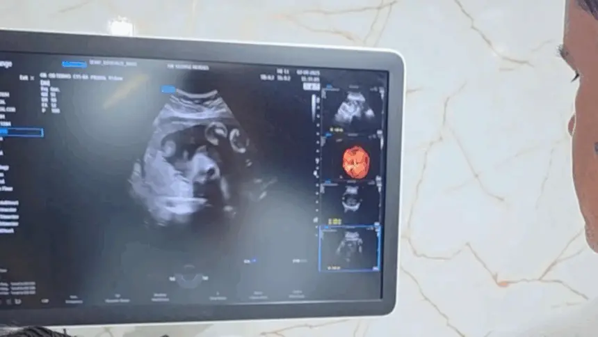 Renato de Castro anuncia parceria com deputada Flávia Moraes e traz clínica móvel com exames gratuitos