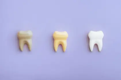5 mitos e verdades sobre manchas nos dentes