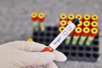 Período chuvoso pede mais atenção contra a dengue – Portal Goiás