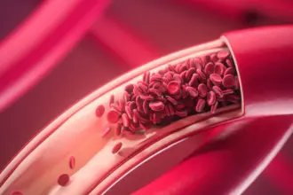 Como o calor e as viagens podem aumentar o risco de trombose no fim de ano