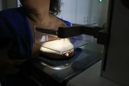 Vigitel: 92% das brasileiras entre 50 e 69 anos fizeram mamografia