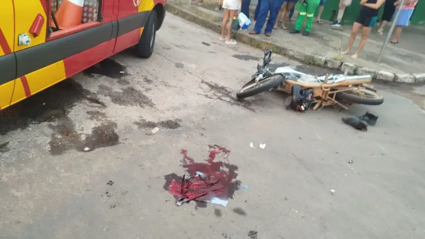 Motociclista sofre fratura exposta durante colisão com camionete no Muniz Falcão Motociclista sofre fratura exposta durante colisão com camionete no Muniz Falcão