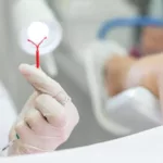 Saúde realiza mutirão de DIU para ampliar acesso ao planejamento reprodutivo – Portal Goiás