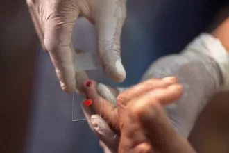 SUS começa a usar novo tratamento contra a malária em crianças