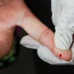 SUS passa a oferecer teste rápido de dengue