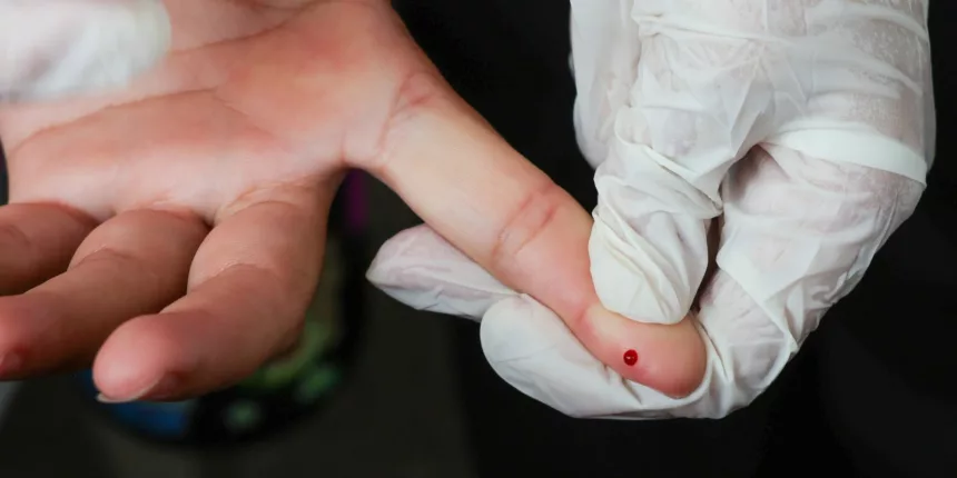 SUS passa a oferecer teste rápido de dengue SUS passa a oferecer teste rápido de dengue