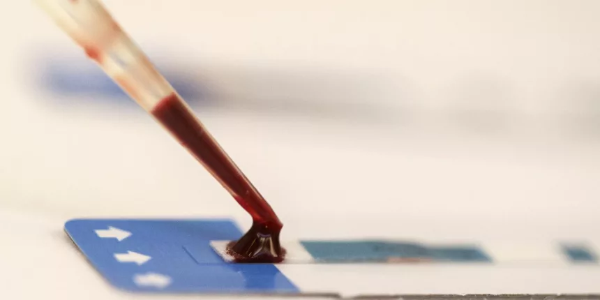 Estudo inédito da Fiocruz pode ampliar prevenção de HIV entre jovens