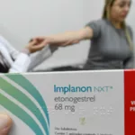 SUS qualifica profissionais para ampliar oferta de implantes hormonais