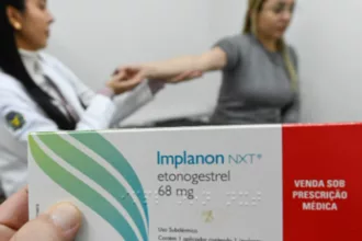 SUS qualifica profissionais para ampliar oferta de implantes hormonais